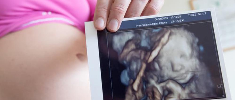 Der test mit Ultraschall (Sonografie) kommt während der Schwangerschaft dreimal zum EInsatz. 