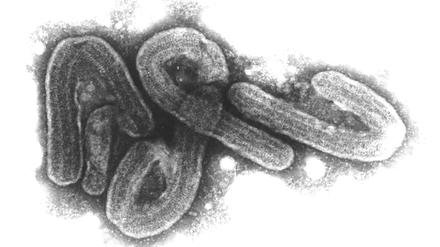 ARCHIV - 07.08.2017, NA, Hamburg: ARCHIV - HANDOUT - Eine elektronenmikroskopische Aufnahme des Marburg-Virus (undatiertes Handout). Das Marburg-Virus gehört zu den gefährlichsten bekannten Krankheitserregern. (zu dpa: «Tansania räumt Todesfall durch Marburg-Virus ein») Foto: Bernhard-Nocht-Institut/dpa +++ dpa-Bildfunk +++