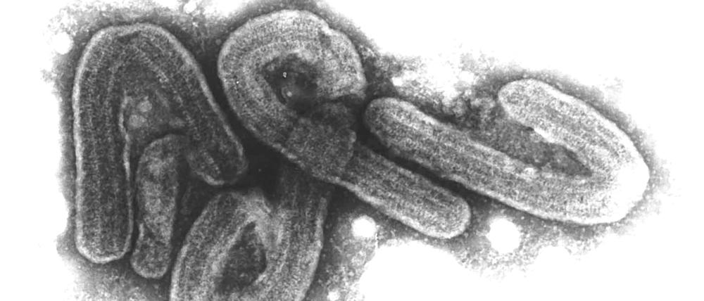 ARCHIV - 07.08.2017, NA, Hamburg: ARCHIV - HANDOUT - Eine elektronenmikroskopische Aufnahme des Marburg-Virus (undatiertes Handout). Das Marburg-Virus gehört zu den gefährlichsten bekannten Krankheitserregern. (zu dpa: «Tansania räumt Todesfall durch Marburg-Virus ein») Foto: Bernhard-Nocht-Institut/dpa +++ dpa-Bildfunk +++