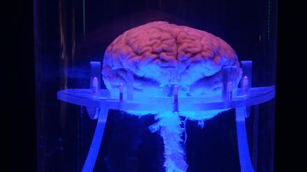 Dallas-human-brain