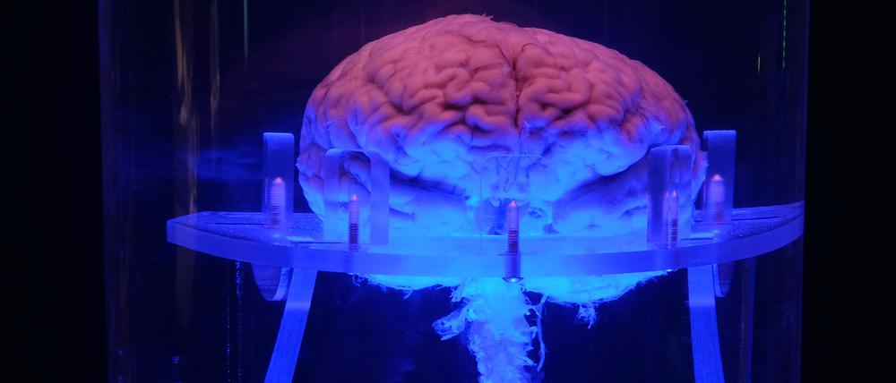 Dallas-human-brain