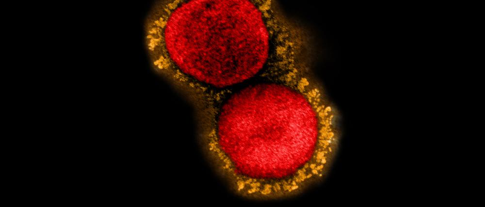 Äußerlich nicht vom Wildtyp zu unterscheiden, haben Mutationen die britische Variante von Sars-CoV-2 zum vorherrschenden Erreger in Deutschland werden lassen.