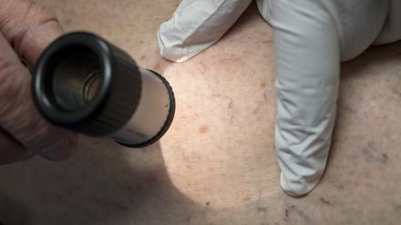 Ein Arzt untersucht in der Praxis die Hautpartie eines Patienten.