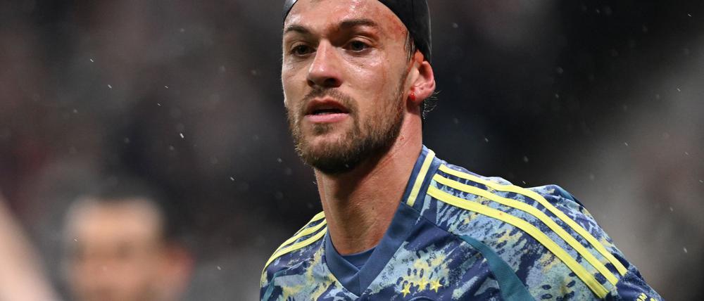 Daniele Rugani bedeckte seine Platzwunde zunächst mit einer Badekappe.