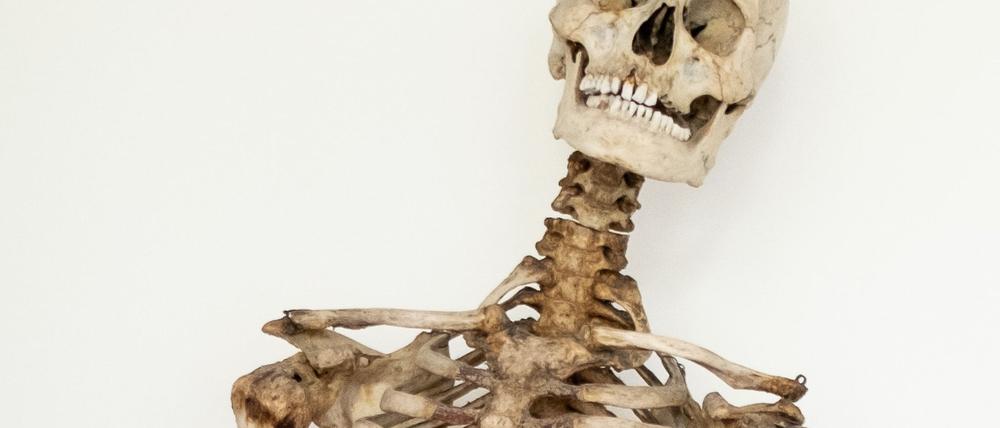 Dank wissenschaftlicher Analysen und eines Verwandten weiß man nun, dass dieses Skelett die sterblichen Überreste des Räubers Schinderhannes sind.