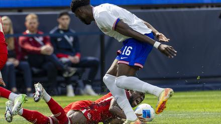 Große Schmerzen. Alphonso Davies fehlt dem FC Bayern München verletzungsbedingt noch lange.