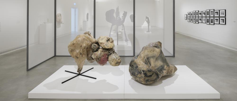 Die Verbildlichung einer Krebserkrankung: Ausstellungsansicht von Alina Szapocznikows „Tumeurs accumulées II“ von 1970 und „Grand tumeur II“ von 1969 im Ravensburger Museum.