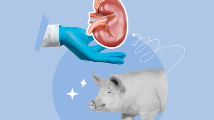 Schweinenieren könnten eine Alternative zum dramatischen Organmangel sein. 