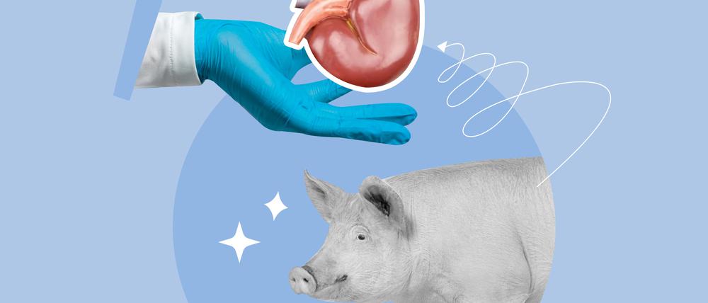 Schweinenieren könnten eine Alternative zum dramatischen Organmangel sein. 
