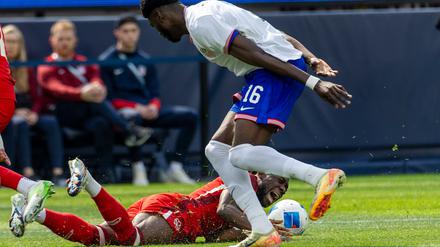 Bayern-Profi Alphonso Davies verletzte sich im Länderspiel gegen die USA.