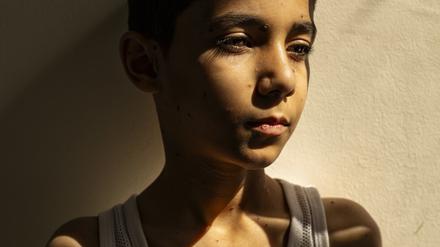 Dieses von „World Press Photo“ herausgegebene Foto zeigt Mahmoud Ajjour (9), der während des Gaza-Kriegs von einer Rakete eines israelischen Kampfflugzeugs getroffen wurde und beide Arme verlor.
