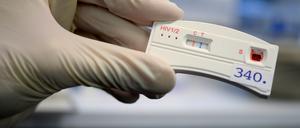 Infiziert oder nicht? Ein HIV-Schnelltest gibt Gewissheit. Aids-Hilfen bieten ihn an. 