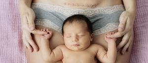 Fast jedes dritte Kind in Deutschland kommt per Kaiserschnitt zur Welt.