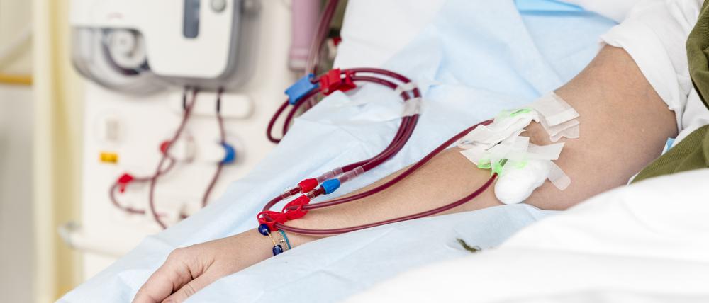 Mit sogenannten Immunadsorptionen lassen sich die Autoantikörper entfernen, was bei vielen Erkrankten zu einer vorübergehenden Besserung führt. 