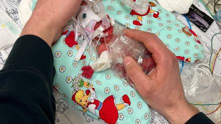 Etwas mehr als ein Päckchen Butter wog die kleine Marie, als sie im Februar zur Welt kam. Seitdem ist das Kind gut gewachsen.