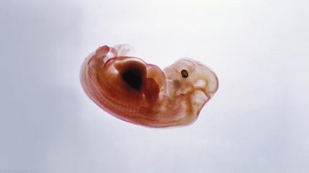 Schwein mit etwas Mensch, Maus mit etwas Ratte: Führen Chimärenexperimente zu mehr Organen für die Transplantationsmedizin? 