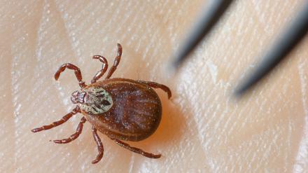Einer Expertin zufolge steigt die Wahrscheinlichkeit einer Borrelien-Infektion etwa 16 bis 20 Stunden nach einem Stich. (Archivbild)