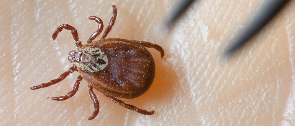 Einer Expertin zufolge steigt die Wahrscheinlichkeit einer Borrelien-Infektion etwa 16 bis 20 Stunden nach einem Stich. (Archivbild)