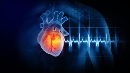 Ein EKG schafft Klarheit über Herzerkrankungen. (Symbolbild)