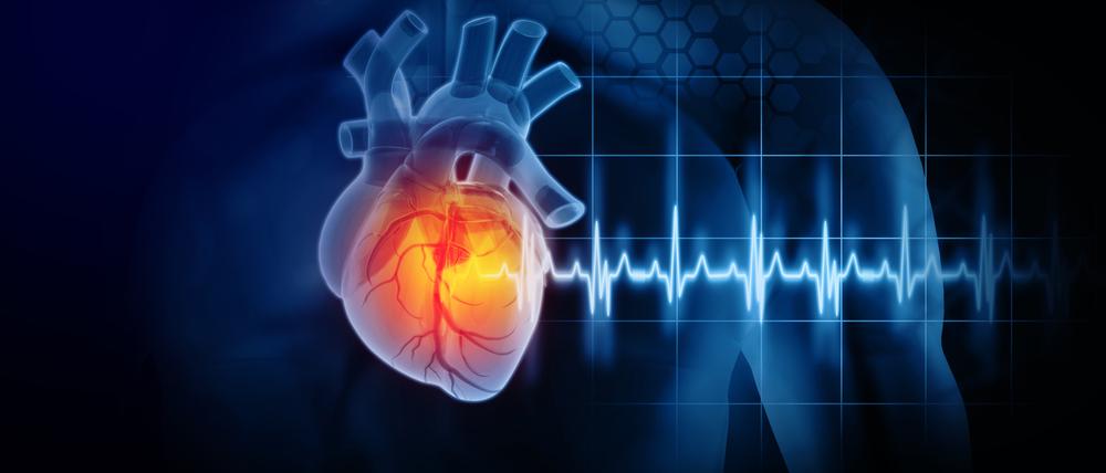 Ein EKG schafft Klarheit über Herzerkrankungen. (Symbolbild)