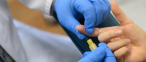 Blutentnahme für einen HIV-Test.