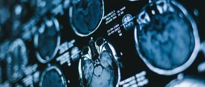 Mit bildgebenden Verfahren lässt sich ins Körperinnere leuchten. 