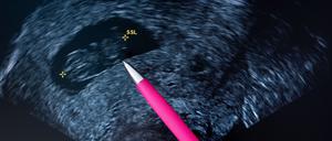 Bei der Legalisierung des Schwangerschaftsabbruchs ist das Nein der Union hart.