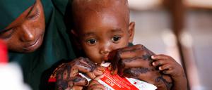 Die Somalierin Adar Hassan Abdulahi hilft ihrem Kind nach einer Impfung.