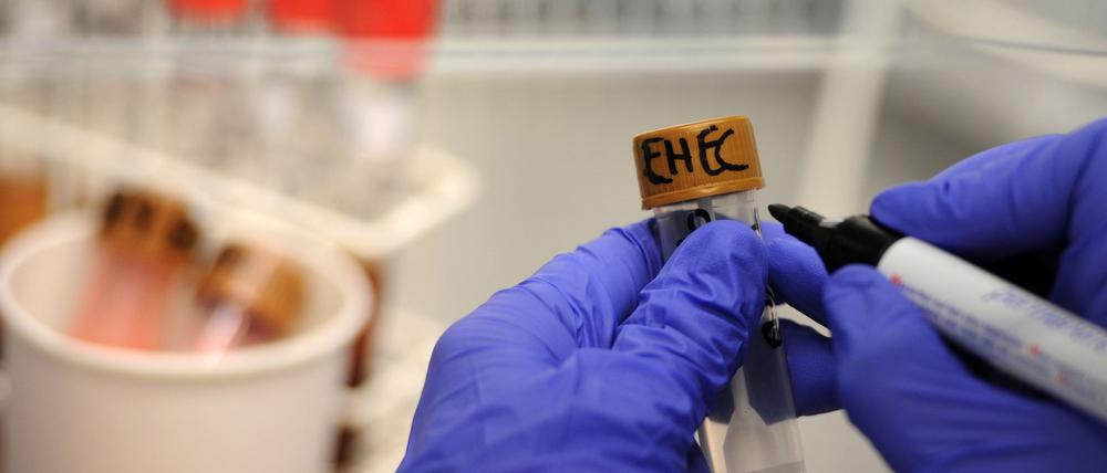 Rinder-Salami wird wegen einer möglichen bakteriellen Belastung zurückgerufen. (Symbolbild)