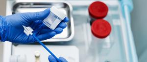 Gynäkologen machen zur Krebs-Früherkennung den sogenannten Pap-Abstrich.