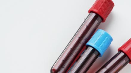 Röhrchen mit Blut für einen Bluttest (Symbolbild)