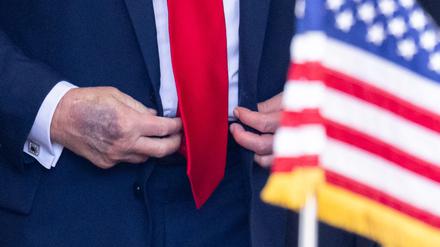 Bei einem Termin im Weißen Haus ist ein Bluterguss auf der rechten Hand des US-Präsidenten Donald Trump zu erkennen. 
