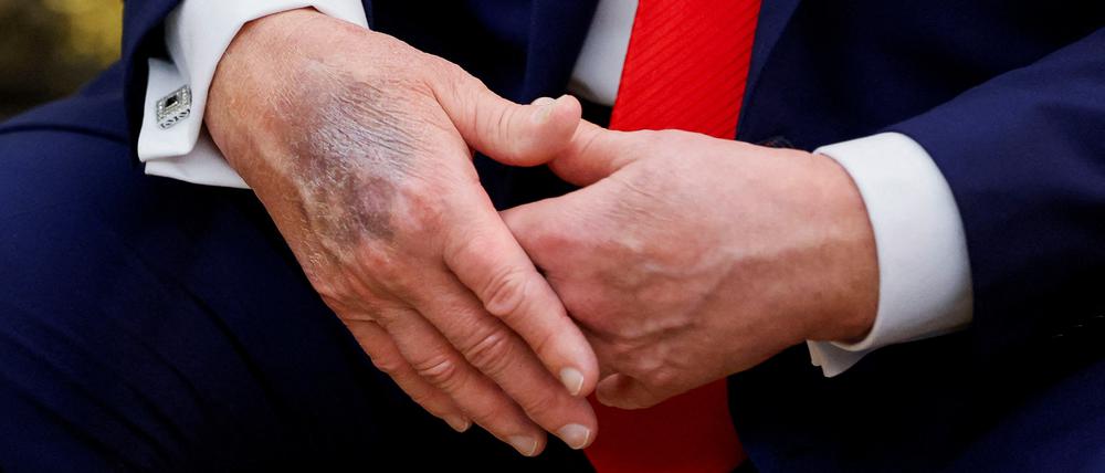 Die Hand des US-Präsidenten Donald Trump im Oval Office am 25. August.