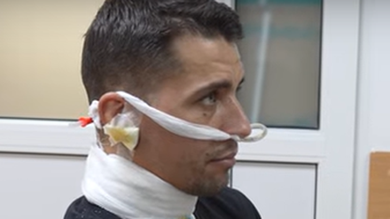 Ukrainischer Soldat rettet sich mit durchgeschnittener Kehle ins Krankenhaus