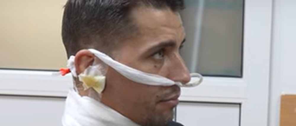 Ukrainischer Soldat rettet sich mit durchgeschnittener Kehle ins Krankenhaus