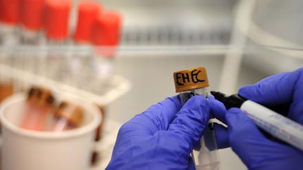 Ehec steht für Enterohämorrhagische Escherichia coli und bezeichnet bestimmte krankmachende Stämme dieses im Darm vorkommenden Bakteriums (Symbolbild).