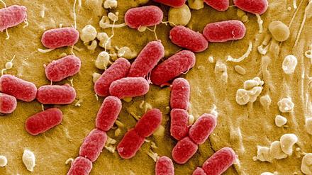 Ehec-Bakterien unterscheiden sich äußerlich nicht von gewöhnlichen, harmlosen Escherichia coli-Bakterien.