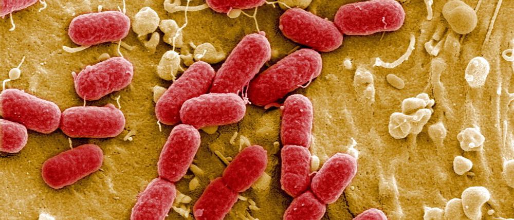 Ehec-Bakterien unterscheiden sich äußerlich nicht von gewöhnlichen, harmlosen Escherichia coli-Bakterien.