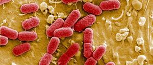 Ehec-Bakterien unterscheiden sich äußerlich nicht von gewöhnlichen, harmlosen Escherichia coli-Bakterien.