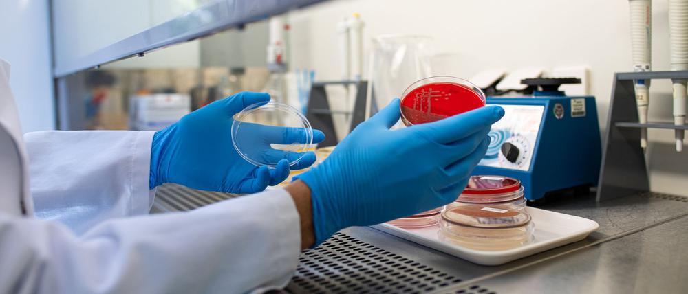 Prof. Alexander Mellmann, EHEC-Experte, Facharzt für Mikrobiologe und Hygiene am Universitätsklinikum Münster, untersucht Proben verschiedener Keime, die auf Petrischalen kultiviert werden. (Symbolbild)