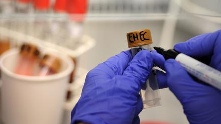 Eine Medizinisch-Technische Assistentin arbeitet unter einer Abzugshaube im Universitätsklinikum Hamburg-Eppendorf (UKE) an Stuhlproben, die auf EHEC-Bakterienstämme untersucht werden.