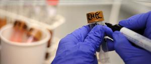 Eine Medizinisch-Technische Assistentin arbeitet unter einer Abzugshaube im Universitätsklinikum Hamburg-Eppendorf (UKE) an Stuhlproben, die auf EHEC-Bakterienstämme untersucht werden.