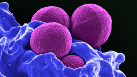 Antibiotika-resistente Varianten der sonst harmlosen, kugelförmigen Bakterien Staphylococcus aureus können für Menschen lebensgefährlich werden. 