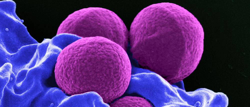 Antibiotika-resistente Varianten der sonst harmlosen, kugelförmigen Bakterien Staphylococcus aureus können für Menschen lebensgefährlich werden. 