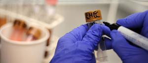 Vier EHEC-Fälle aus Brandenburg werden mit dem Ausbruch in Mecklenburg-Vorpommern in Verbindung gebracht. (Archivbild)