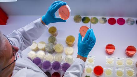 Im Labor des Landesamts für Landwirtschaft, Lebensmittelsicherheit und Fischerei untersucht ein Mitarbeiter Trägerplatten mit dem Bakterium bacillus cereus. Anhand der Proben können Mitarbeiter die Art und Anzahl von Keimen bei getesteten Lebensmitteln bestimmen. Derzeit werden verstärkt Proben auf Ehec untersucht.