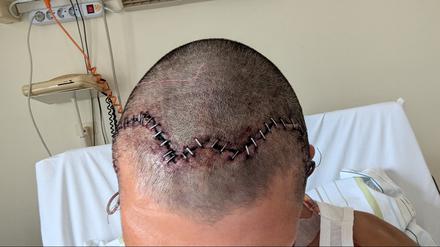 Nour im Krankenach der Attacke.