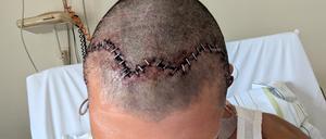 Nour im Krankenach der Attacke.