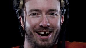Ein Eishockeyspieler gibt den Blick frei auf zwei fehlende Schneidezähne. 