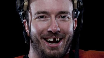 Ein Eishockeyspieler gibt den Blick frei auf zwei fehlende Schneidezähne. 